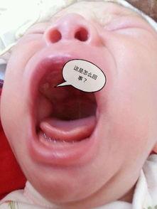 新生儿牙龈图片,揭秘宝宝牙龈的初生之美